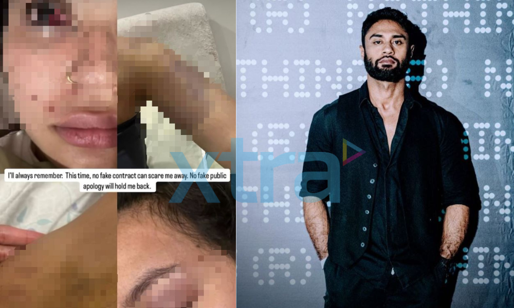 Bekas Kekasih Ammar Alfian Dedah Bukti Dibelasah -“Berapa Kali Kau C*kik Aku, Sampai Pengsan! Lepastu Tamp*r Aku”